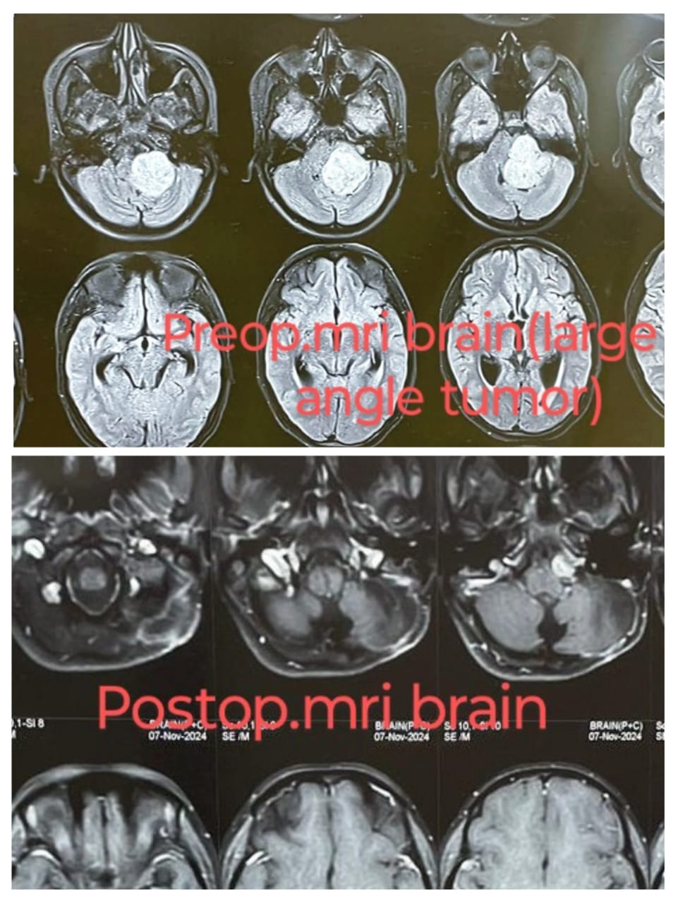 MRI Comparison